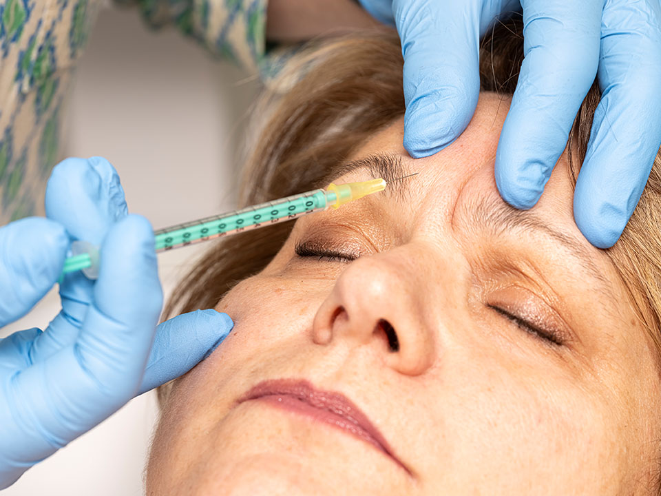 Injections de Botox réalisée par le Dr Cristina Esteban à Antony